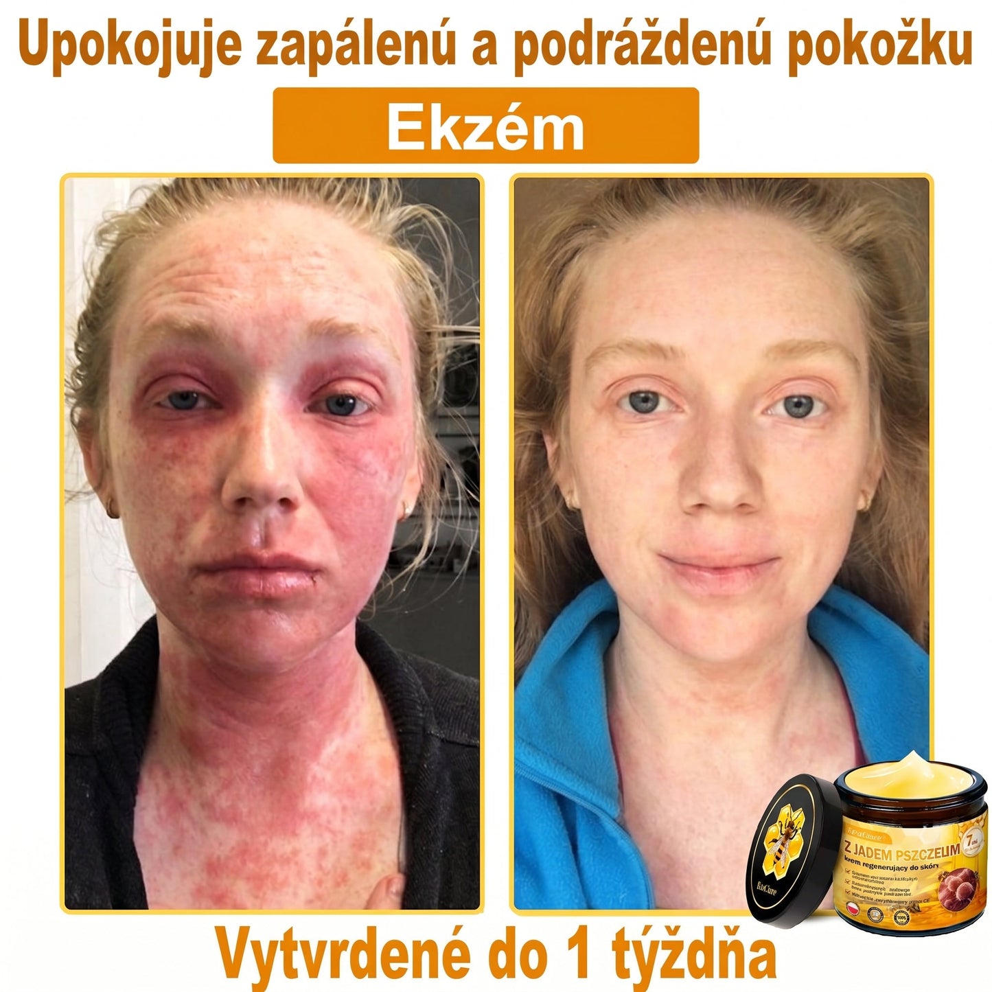 ✨PuraCure® Jad Pszczeli Regeneracja Skóry Krem(👨‍⚕‍CE zatwierdzone)👍✅