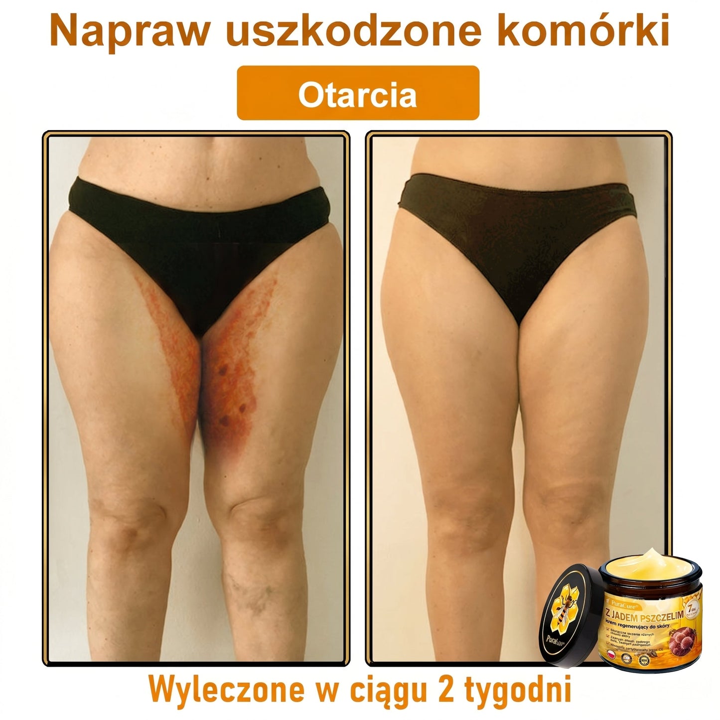 ✨PuraCure® Jad Pszczeli Regeneracja Skóry Krem(👨‍⚕‍CE zatwierdzone)👍✅