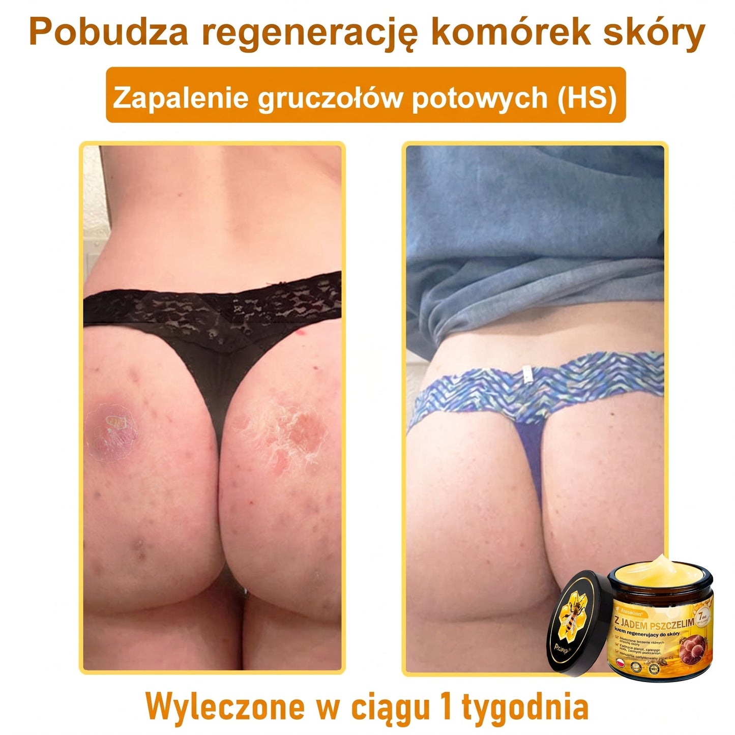 ✨PuraCure® Jad Pszczeli Regeneracja Skóry Krem(👨‍⚕‍CE zatwierdzone)👍✅