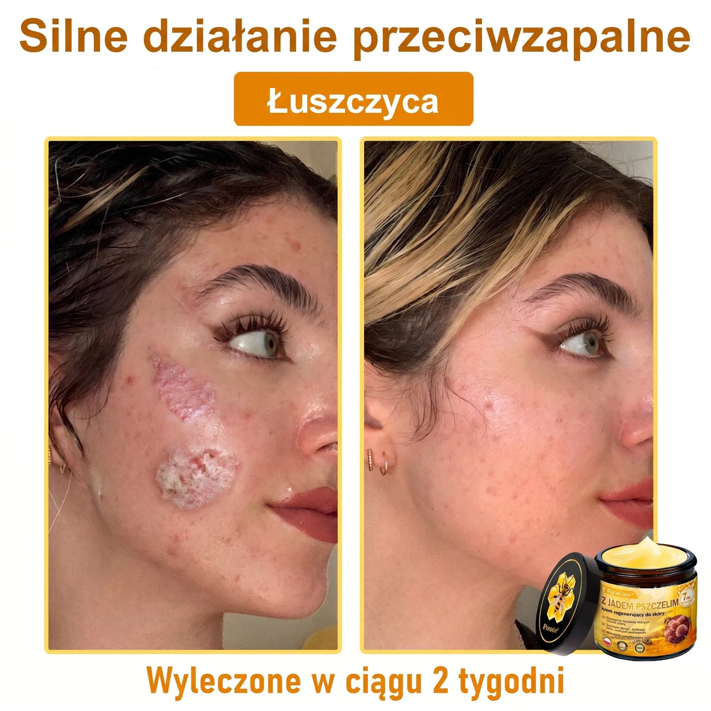 ✨PuraCure® Jad Pszczeli Regeneracja Skóry Krem(👨‍⚕‍CE zatwierdzone)👍✅