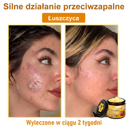 ✨PuraCure® Jad Pszczeli Regeneracja Skóry Krem(👨‍⚕‍CE zatwierdzone)👍✅